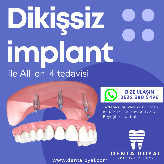 yerli implant fiyatları