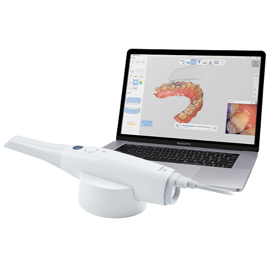 İntra oral scanner